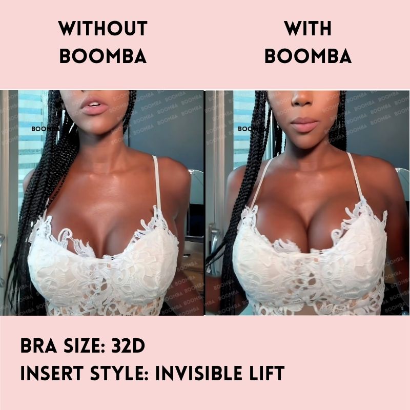 Invisible Lift Inserts®